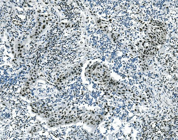Anti-Musashi 1/Msi1 Antibody (monoclonal, 2B9)
