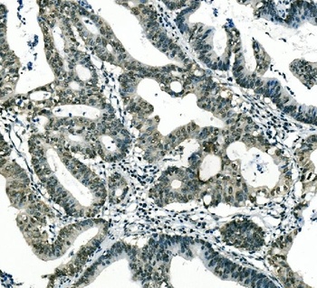 Musashi 1/Msi1 Antibody (monoclonal, 2B9)
