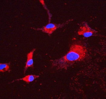 ATP5H in Antibody (monoclonal, 6B12)