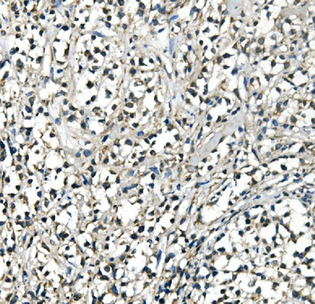 ATP5H in Antibody (monoclonal, 6B12)