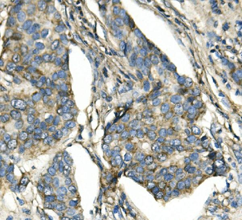 ATP5H in Antibody (monoclonal, 6B12)