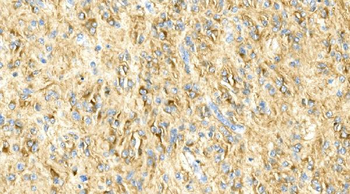 Anti-GFAP Antibody (monoclonal, 3F2)