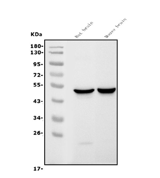 Anti-GFAP Antibody (monoclonal, 3F2)
