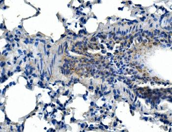 Anti-Adam28 Antibody