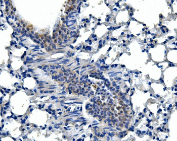 Anti-Adam28 Antibody