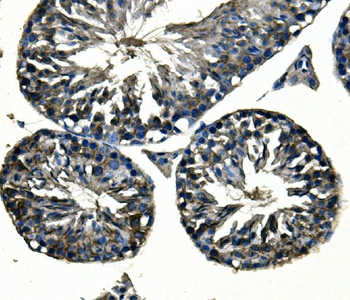 Anti-Adam28 Antibody