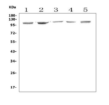 Anti-Aryl hydrocarbon Receptor/Ahr Antibody