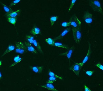 Anti-Angiopoietin-2/ANGPT2 Antibody