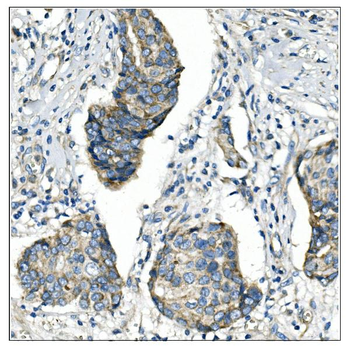 Anti-Angiopoietin-2/ANGPT2 Antibody