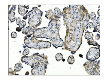 Anti-Angiopoietin-2/ANGPT2 Antibody