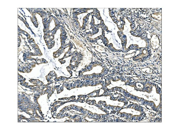Anti-Angiopoietin-2/ANGPT2 Antibody