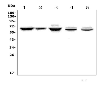 Anti-Angiopoietin-2/ANGPT2 Antibody