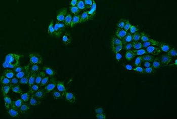 Anti-ACCN1/ASIC2 Antibody
