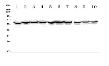 Anti-ACCN1/ASIC2 Antibody