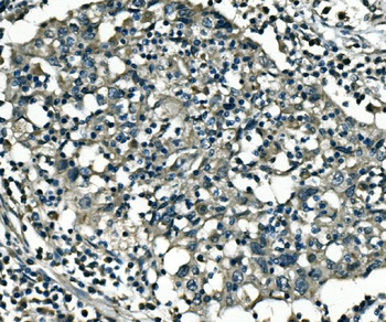 Anti-PCTAIRE1/CDK16 Antibody