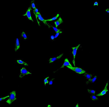 Anti-Choline Acetyltransferase/CHAT Antibody