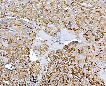 Anti-Choline Acetyltransferase/CHAT Antibody