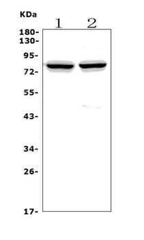 Anti-Choline Acetyltransferase/CHAT Antibody