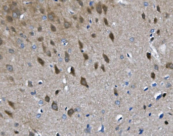 Anti-Choline Acetyltransferase/Chat Antibody
