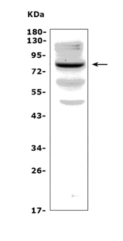 Anti-Choline Acetyltransferase/Chat Antibody