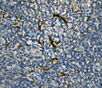 Anti-EIF4A1 Antibody