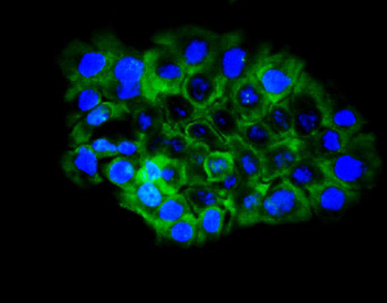 Anti-Eph receptor B2/EPHB2 Antibody