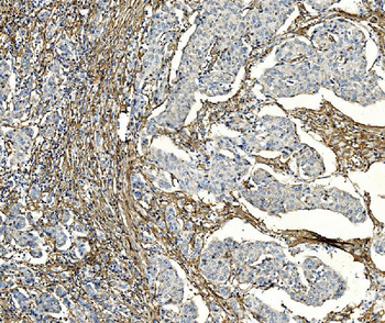 Anti-PAR1/Thrombin Receptor/F2R Antibody