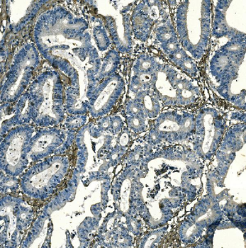 Anti-PAR1/Thrombin Receptor/F2R Antibody
