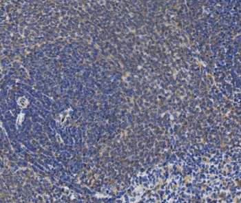 Anti-IRAK2 Antibody