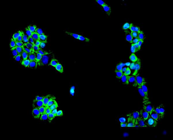 Anti-MC4-R/MC4R Antibody