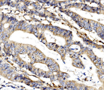 Anti-MC4-R/MC4R Antibody