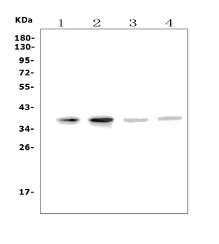 Anti-MC4-R/MC4R Antibody