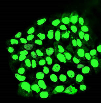Anti-MORC3 Antibody