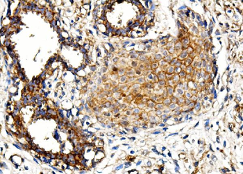Anti-MORC3 Antibody