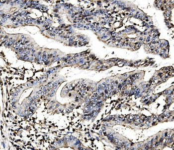 Anti-MORC3 Antibody