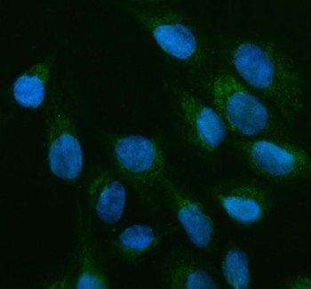 Anti-OFD1 Antibody