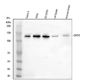 Anti-OFD1 Antibody