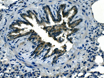 Anti-LOX 1/Olr1 Antibody