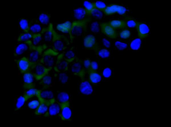 Anti-RICTOR Antibody