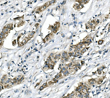 Anti-RICTOR Antibody