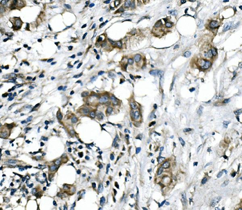 Anti-RICTOR Antibody