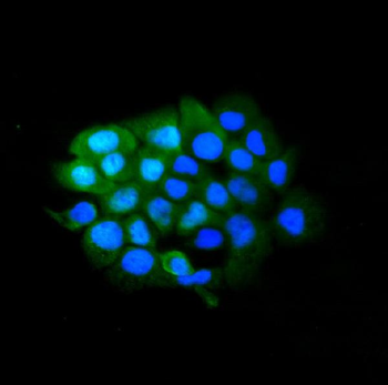 Anti-SLBP Antibody
