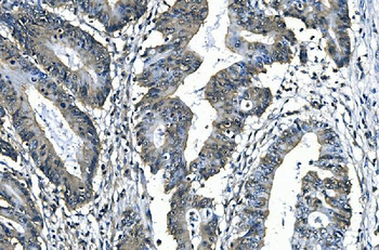 Anti-SLBP Antibody