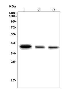 Anti-SLBP Antibody