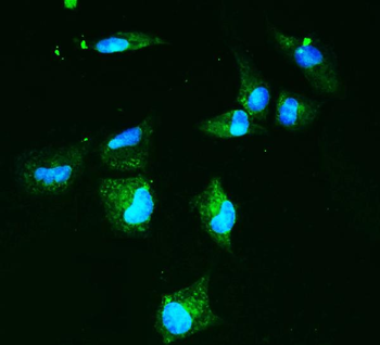 Anti-GLUT9/SLC2A9 Antibody