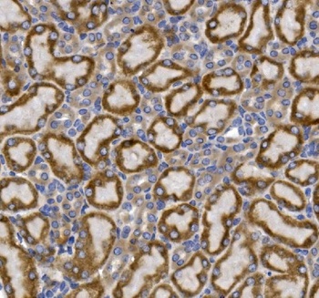 GLUT9/SLC2A9 Antibody