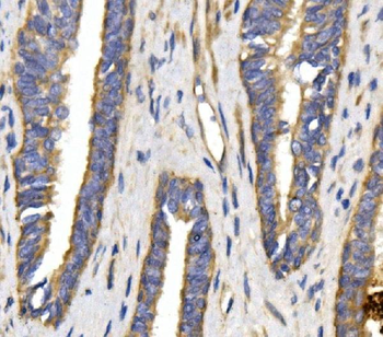 Anti-GLUT9/SLC2A9 Antibody