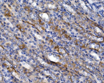 Anti-GLUT9/SLC2A9 Antibody