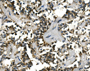 Anti-VMAT1/SLC18A1 Antibody