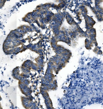 VMAT1/SLC18A1 Antibody